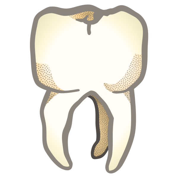 tooth - coloured