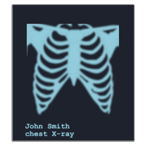 Chest X Ray Image Free Svg