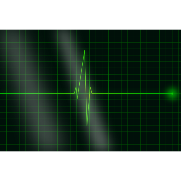 Vector image of electrocardiogram