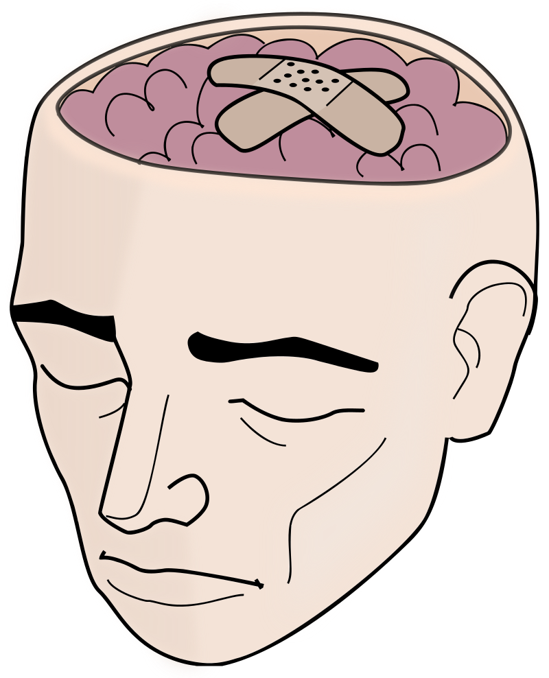 Human Head With Open Brain and Bandages