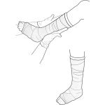 Vector illustration of leg cast examination