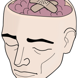 Human Head With Open Brain and Bandages