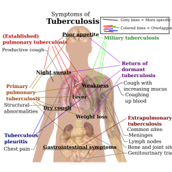 Human body
