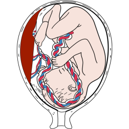 Placenta