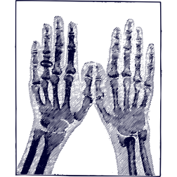 xrayimage